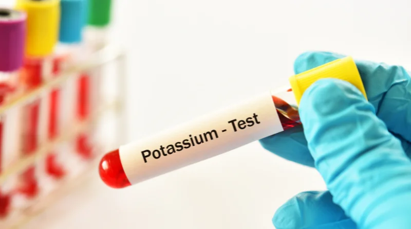 échantillon sang pour analyse en laboratoire du taux de potassium