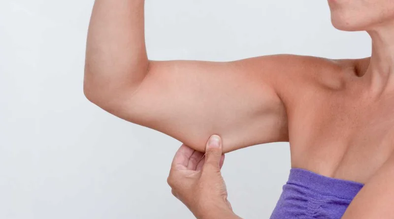 Comment maigrir des bras efficacement ?